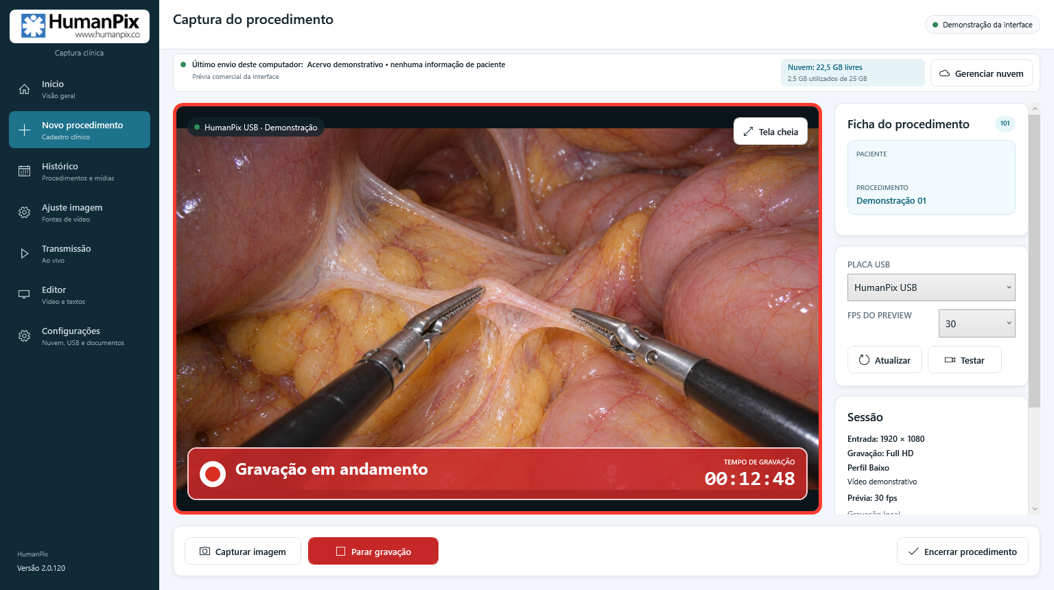Tela real de gravação HumanPix com dados demonstrativos